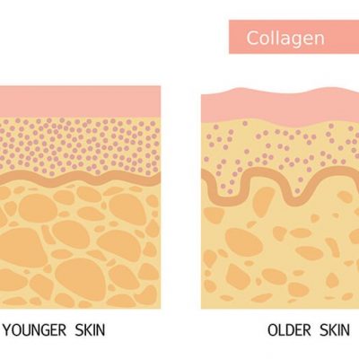Collagen-2